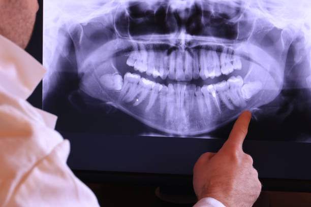 Best Emergency Dental Care for Sports Injuries in Cape Charles, VA